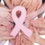 breast_cancer_treatment_options
